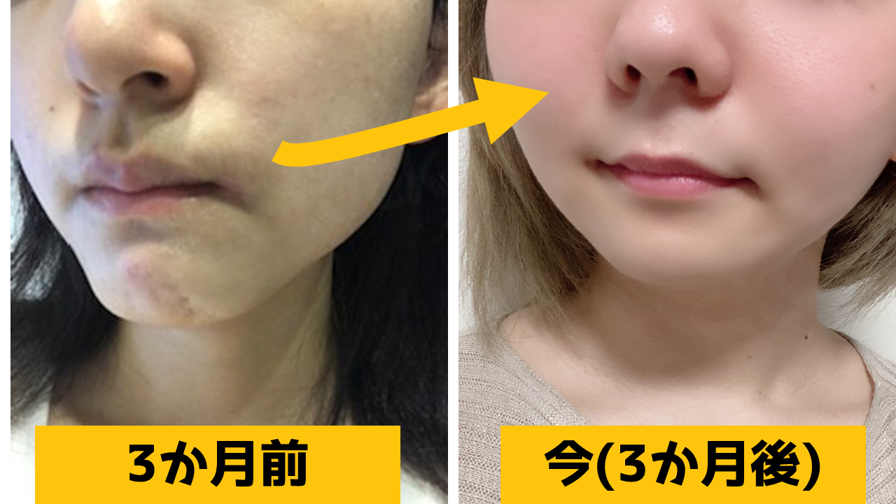 もうすぐ終了 私が鏡を見るのが嬉しくなった あの 琉球すっぽんコラーゲンゼリー がいまだけ500円 500円が26円になる前に Choice